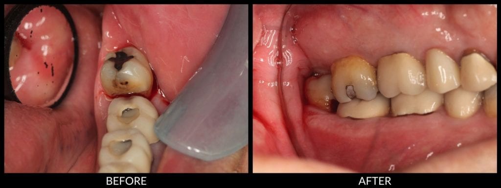 dental exam before and after photo