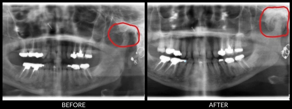 digital xrays before and after xrays
