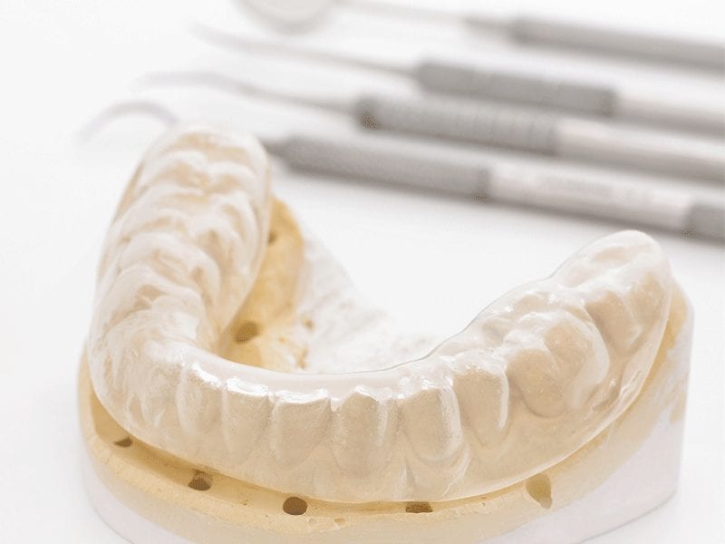 mouth guard on cast of teeth