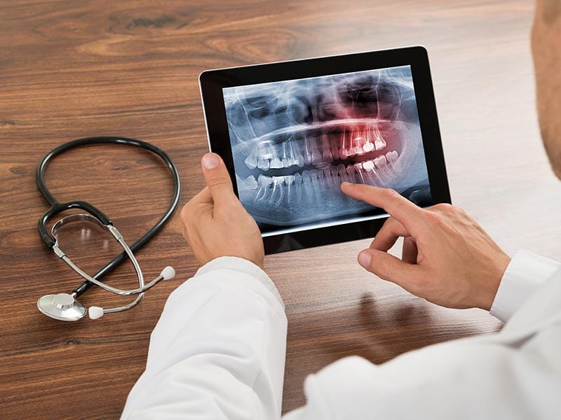 dentist looking at panoramic xray